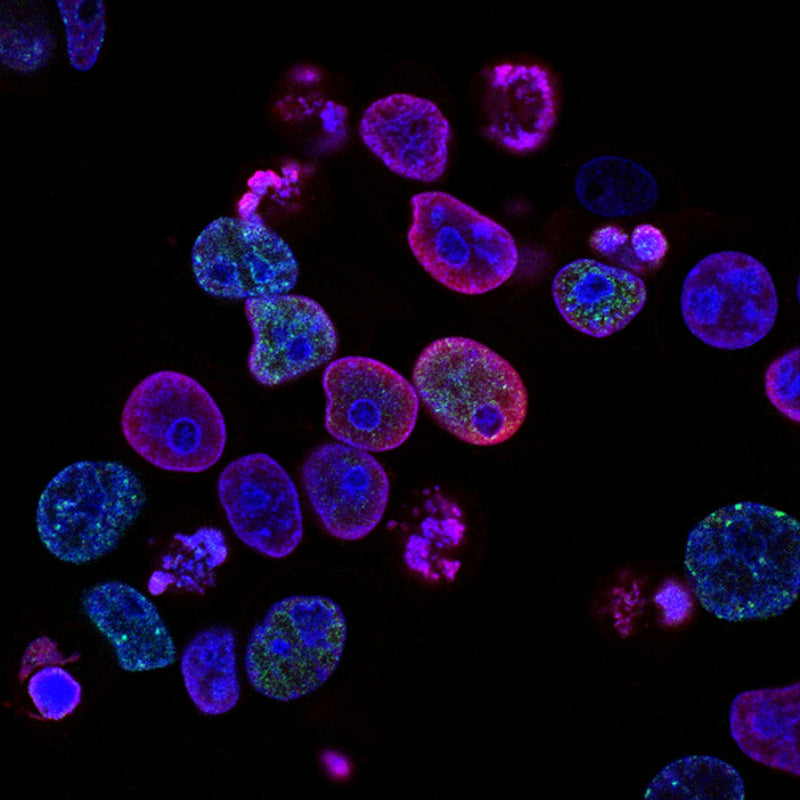 Adaptive immune system: what zinc, vitamin D, and beta-glucans really do